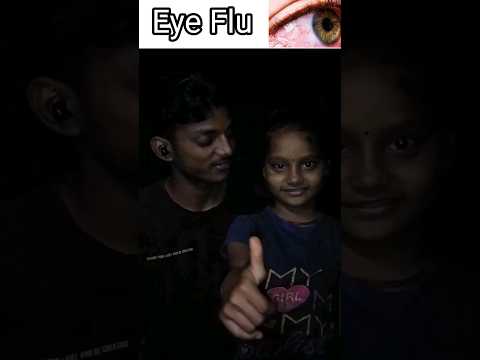 important Eye Flu 😷 इलाज  #youtubeshorts #viralvideo #shortsvideo #trending #ytshorts #shorts