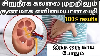 Siruneeraga kal/siruneeraga kallai seriseivathu yeppadi #kidneystone #kidneystoneintamil #howto