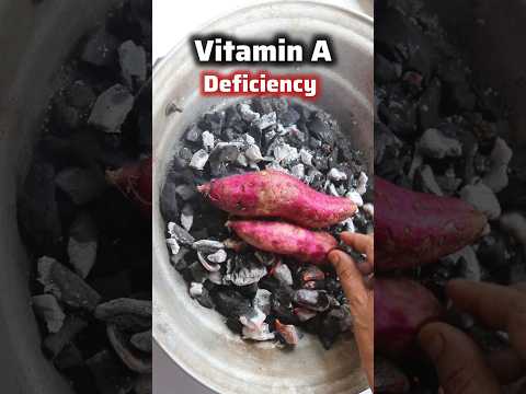 Get 100% of daily dose of Vitamin A with 1 sweet potato/Vitamin A,B,C rich food #shorts #vitaminA