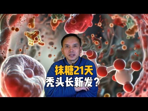 抹糖21天禿頭長新發？遺傳性脫髮研究意外突破，或造福全球近半人口！