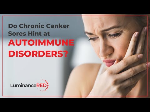 Do Chronic Canker Sores Hint at Autoimmune Conditions?