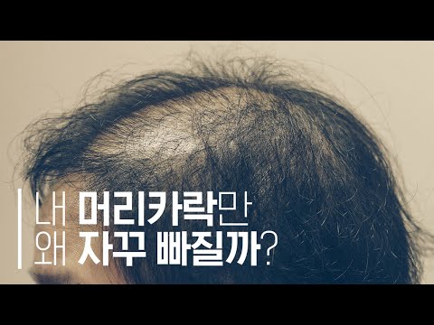 수없이 탈모 샴푸만 바꾸고 있는 당신! (Replacing shampoos is not enough.)