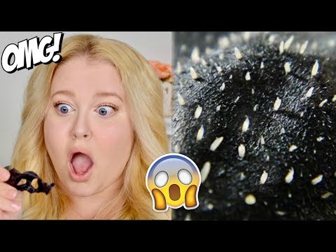 The BEST blackhead removal mask EVER!!!