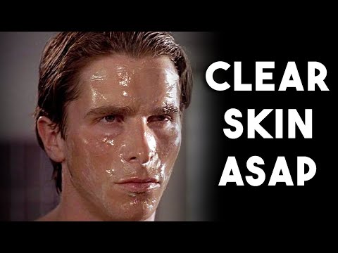 How To Get Clear Skin ASAP (NO BS GUIDE)