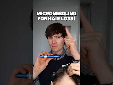 Microneedle go for hair loss!