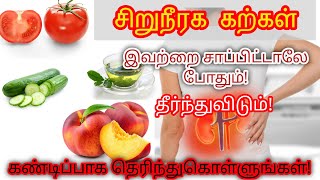 Kidney stone treatment in Tamil | kidney stone pain Tamil | Kidney stone in Tamil | STAR LABORATORY