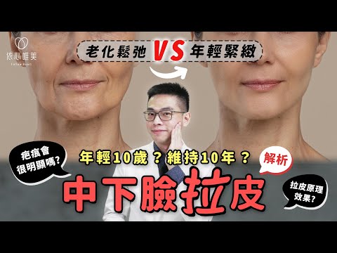 電音波不夠力？靠手術拉到最緊！中下臉拉皮改善根本問題？才能徹底拯救鬆弛下垂！SMAS筋膜層是什麼？｜依心唯美 邱大睿醫師