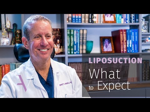 What to Expect When Getting Liposuction: The Cosmetic Surgery Journey