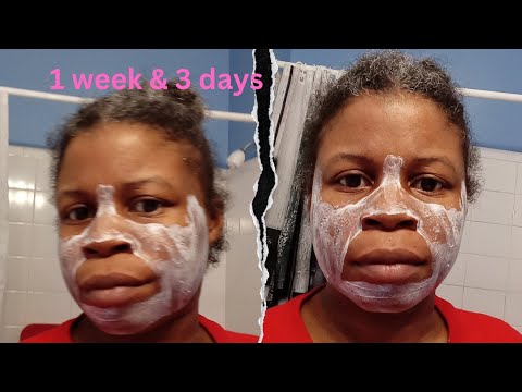 Revealing My Glowing Skin Secrets!