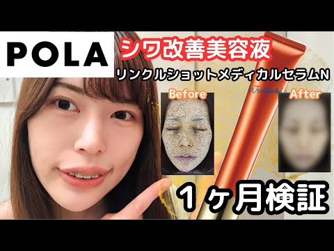 【シワ改善美容液】POLAリンクルショットメディカルセラムN 半顔検証してみた！