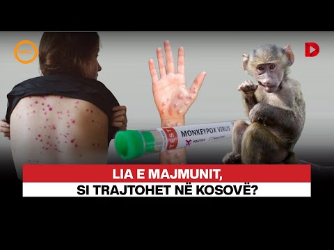 🔴LIA E MAJMUNIT, SI TRAJTOHET NË KOSOVË? - RRETH E RROTULL