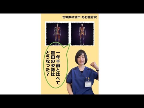 【姿勢改善】姿勢がどれだけ変わったのか大公開！｜茨城県結城市 あお整骨院　#short