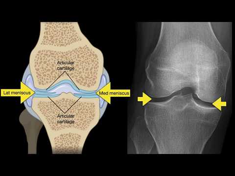 Anatomy of Knee X-rays