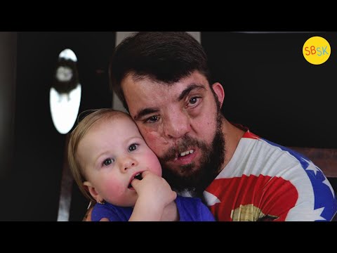 Disabled and Abandoned at Birth (Now He's a Father of 5)