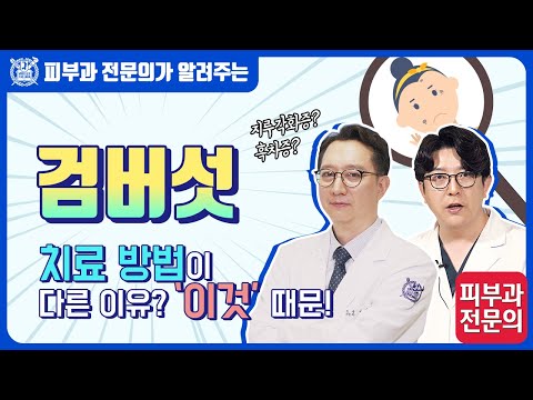 검버섯, 지루각화증, 흑자증 I 치료 방법이 다른 이유 ‘이것’ 때문!