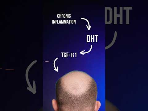 Does DHT cause Male hair loss?