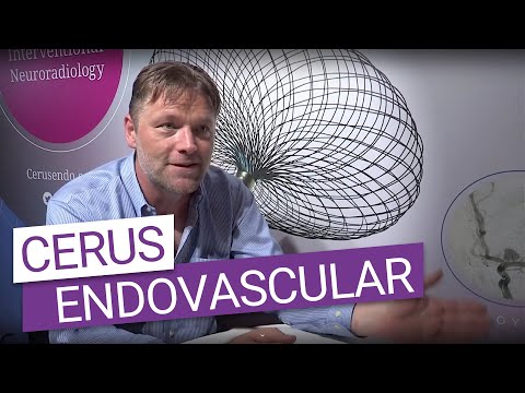 Providing the tools for the interventional neuroradiologist – Cerus Endovascular