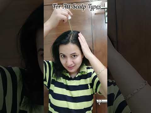 Anti Dandruff Serum Best For Winter / Plix Anti Dandruff Serum #shortsvideo #review #plix