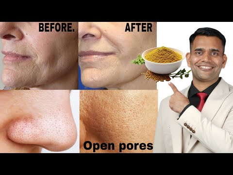 1 Home Remedy For Skin Tightening and Open pores