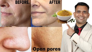 1 Home Remedy For Skin Tightening and Open pores