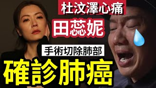 田蕊妮確診肺癌！手術「切除肺部」杜汶澤吸煙係原兇？原來肺腺癌「女人佔大多數」六類人病發「高出20倍」戒煙15年才可減低風險！#田蕊妮的士 #杜汶澤喱騷 #杜氏聞情 #tvb視后#podcast