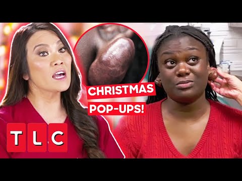 Dr. Lee's Festive Holiday Pop-Ups | Dr. Pimple Popper