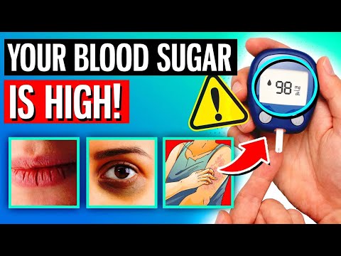 12 WARNING Signs Your Blood Sugar Is Extremely High