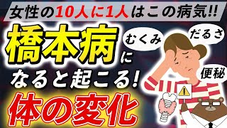 絶対に知っておきたい「橋本病」（甲状腺機能低下症）の超意外な症状とは？体に起きるサインを見逃さないで！