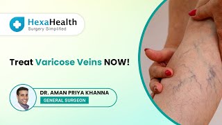 Treatment options for Varicose Veins ||What is Endovenous Laser Ablation? || HexaHealth Expert