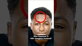 What happened to NBA YoungBoy's forehead? 🤔