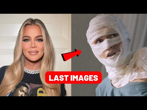 Khloe Kardashian Became Unrecognizable Because of Aesthetics!