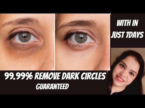 7 दिनों के अंदर आंखो के काले घेरे हटाने के घरेलू नुस्खे, how to remove dark circles in one week.