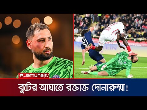 উইলফ্রেডের বুটের আ*ঘা*তে ক্ষ*তবি*ক্ষ*ত দোন্নারুম্মার মুখ! নীরব রেফারি | Donnarumma | Jamuna Sports