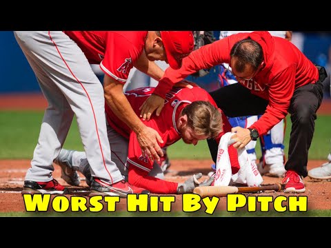 MLB | Hard Hit By Pitch