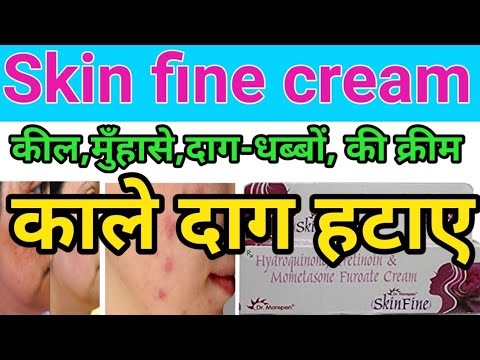 Skin Fine Cream Review Benefits Use In Hindi,Skin Fine Cream, #skinfinecream #cngajbhiye