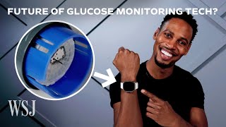 The Real Reason the Apple Watch Lacks Glucose Monitoring