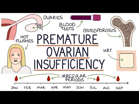 Understanding Early Menopause: Premature Ovarian Insufficiency