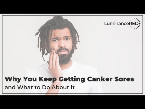 Why You Keep Getting Canker Sores and What to Do About It