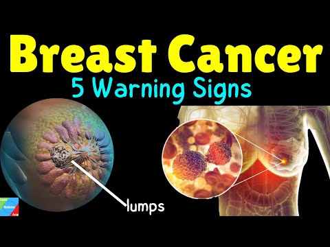 💗What are the 5 Warning Signs of Breast Cancer? | What are the Symptoms of Breast Cancer?