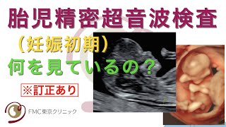 【出生前診断】妊娠初期の精密超音波検査では、何を見ているのか　※訂正あり（概要欄をご確認ください）