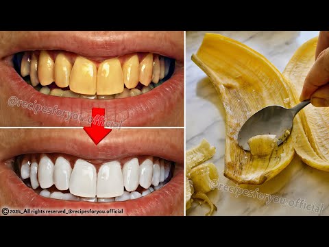 Secret that Dentists don't want you to know: Remove Tartar and Teeth Whitening in just 2 minutes🪥🦷