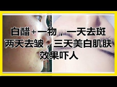 白醋+一物，一天去斑，兩天去皺，三天美白肌膚，效果嚇人。