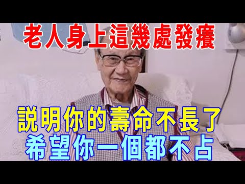 活了100歲的老人說：身上這幾處發癢，說明你的壽命不長了！但如果你一個都不占，活到99歲沒問題！