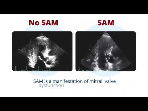 American Society of Echocardiography: Training Module 6