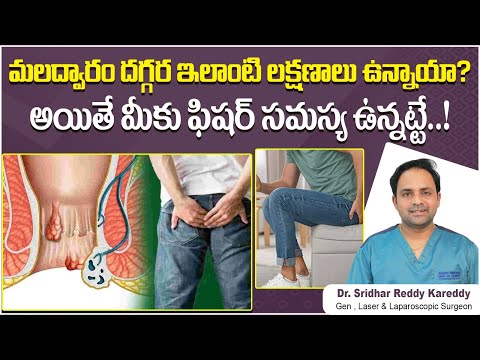 Fissure Symptoms and Cure in Telugu || Best Treatment for Anal Fissure in Telugu || Treatment Range