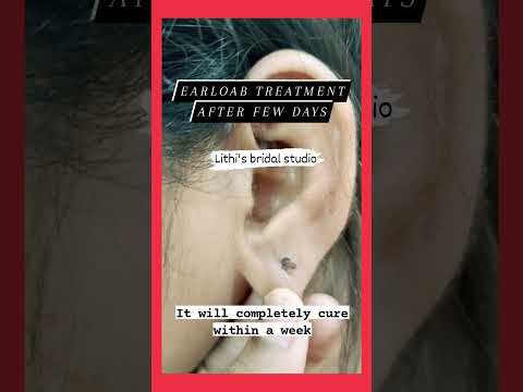 Earlobe surgery without pain 👂// earlobe surgery #shorts #youtubeshort