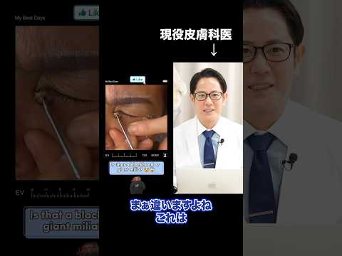 巨大角栓か稗粒腫？違います、病理検査してください【警告】