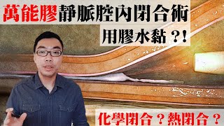 靜脈曲張治療：萬能膠/靜脈膠（VenaSeal）靜脈腔內閉合術簡介｜許原彰醫師：台中，高雄，台南，台北，新竹，靜脈曲張專家