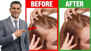 How to grow thin hair to thick hair fast - Dr. Vivek Joshi