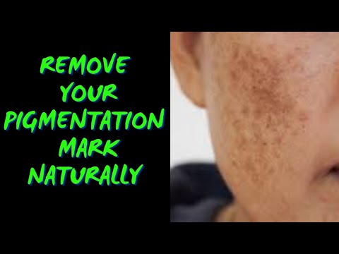 Best Natural remedy for Black Dark Patch on face or Pigmentation